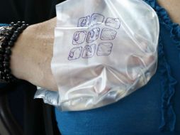 La prueba Oncotype DX es la única prueba genómica validada por su capacidad para predecir el beneficio de la quimioterapia. NTX / ARCHIVO