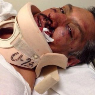 El IEDF investiga violencia en Cuajimalpa