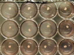 Las células madre son modificadas por una serie de factores de crecimiento para los objetivos comentados. EFE / ARCHIVO