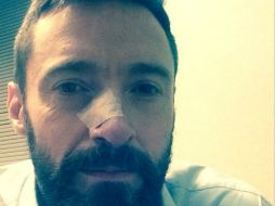 En 2013 fue diagnosticado con carcinoma de células basales, algo a lo que contribuyo el tiempo de tomar sol sin protección. INSTAGRAM / @thehughjackman