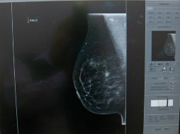 Es necesario llevar a cabo más estudios para establecer exactamente cómo es que interactúan las células óseas y las enzimas LOX. EL INFORMADOR / ARCHIVO