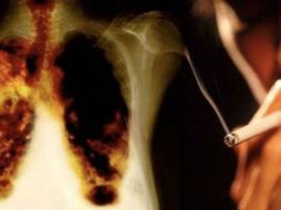 Vencer la adicción al cigarro es posible y por fortuna no todos los fumadores llegan a presentar síndrome de abstinencia. FACEBOOK / IMSS Jalisco