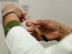 Además del arsénico, detectan también aluminio, fierro y cobre en sangre de voluntarios que ya presentaban enfermedades en la piel. SUN / ARCHIVO