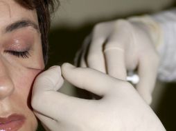 El botox es el más solicitado entre las pacientes argentinas. EL INFORMADOR / ARCHIVO