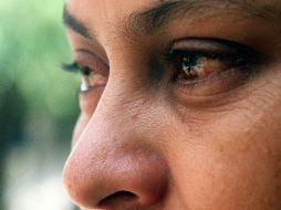 El problema se agudiza entre los adolescentes con exceso de producción de grasa por cuestiones hormonales.es hormonales. EL INFORMADOR / ARCHIVO