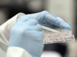 Se teme que el Alzheimer pueda ser transmitido por vías como transfusiones de sangre o instrumentos quirúrgicos contaminados. NTX / ARCHIVO