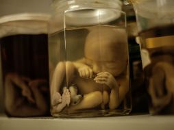 La primera inyección de células embrionarias en fetos se realizará entre las semanas 20 y 34 del embarazo. EL INFORMADOR / ARCHIVO