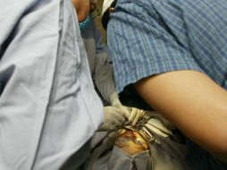 Los pacientes con paladar hendido presentan una disminución considerable de la apertura del labio sin necesidad de una operación. EL INFORMADOR / ARCHIVO