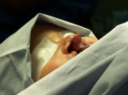 El invento evita el avance de la malformación y permite una movilidad mayor del labio. EL INFORMADOR / ARCHIVO