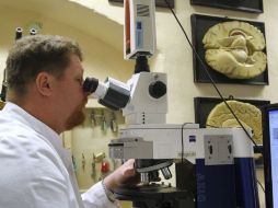 Explican que en el caso del cerebro masculino predomina la inclinación hacia el sexo, mientras que el femenino se apega al compromiso. EFE / ARCHIVO