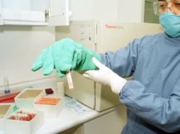 Las pruebas de genética molecular permiten identificar cuál es el tratamiento adecuado para el paciente. NTX / ARCHIVO