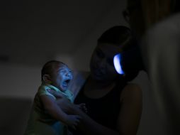 En Brasil se han identificado cuatro mil 200 posibles casos de microcefalia en bebés que pueden tener relación con el virus. AP / F. Dana