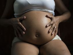 En Brasil, muchos niños cuyas madres tuvieron zika en los primeros meses de embarazo, nacieron con microcefalia. AP / F. Dana