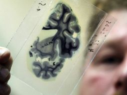 Las adulteraciones provocan que el cerebro de los consumidores no detecte las consecuencias adversas de su comportamiento. EFE / ARCHIVO