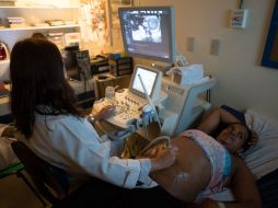 Embarazada durante una revisión en una clínica de Recife, Brasil. NTX /