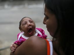 Desde octubre, Brasil ha reportado cinco mil 79 casos sospechosos de microcefalia, de acuerdo con las últimas cifras. EFE / A. Lacerda