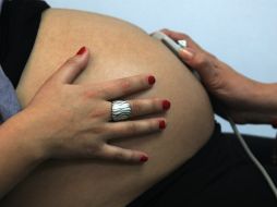 Otras dos mujeres han sufrido abortos involuntarios y una más dio a luz a un bebé con defectos congénitos graves. AFP / ARCHIVO