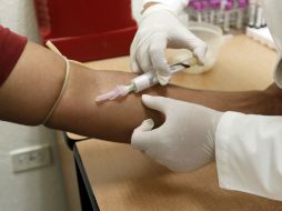 La prueba cuenta con una elevada sensibilidad y especificidad para su detección oportuna. EL INFORMADOR / ARCHIVO