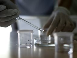 El estudio muestra una posible meningoencefalitis, una inflamación importante y compatible con una infección. EFE / ARCHIVO