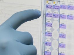 La alteración de las células que manifiestan la proteína Axl es consistente con los problemas de salud del feto. AP / A. Franco