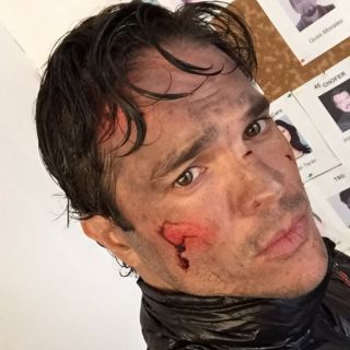 Kuno Becker podría perder visión en un ojo