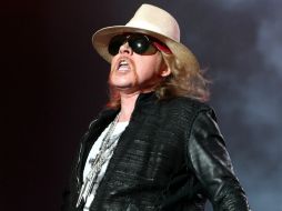 Explican que el hueso del intérprete fue sometido a una reducción abierta y fijación interna. EFE / ARCHIVO