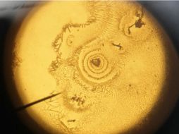 La nanopartícula podría emplearse también contra alergias alimentarias. EFE / ARCHIVO