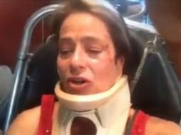Debido a la agresión, la actriz resultó con golpes en el rostro. FACEBOOK / America Gabriel