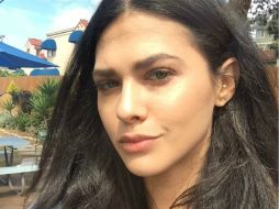 Adams sube a su cuenta de Instagram una fotografía con el ojo morado, consecuencia del accidente. INSTAGRAM / thejessadams