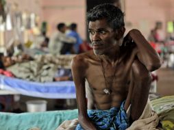 Se estima que a nivel mundial, 480 mil personas padecen TB-MDR. AP / ARCHIVO