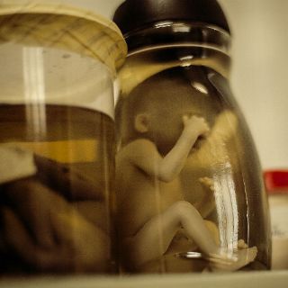 Holanda autoriza el uso de embriones con fines científicos