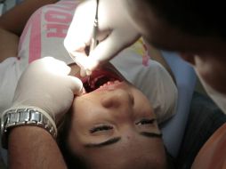 Se caracteriza por la presencia de hemorragias en la piel en forma de mancha, sangrado de nariz y encías. EL INFORMADOR / ARCHIVO