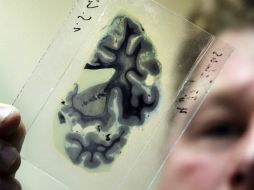 La novedad de la técnica es que analiza a profundidad las sinapsis, es decir, la transmisión del impulso nervioso. EFE / ARCHIVO