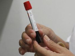 La sangre de pacientes con hemofilia no tiene la cantidad suficiente de alguno de los elementos de coagulación. EL INFORMADOR / ARCHIVO