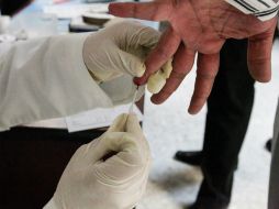 El uso del receptor P2X7 podría ser estimulado como terapia para que las personas propensas a la diabetes por rasgos genéticos. EL INFORMADOR / ARCHIVO