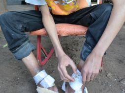 Se resaltó la necesidad de establecer estrategias para el diagnóstico, tratamiento y prevención de ataques de animales ponsoñozos. SUN / ARCHIVO