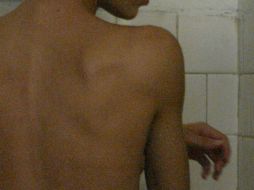 Médicos buscan evitar que la estadística de mujeres afectadas por esta enfermedad aumente. EL INFORMADOR / ARCHIVO