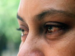 La conjuntivitis es súper común y afecta a tres millones de personas al año. EL INFORMADOR / ARCHIVO