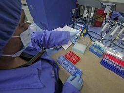 La expresión de estas proteínas se puede iniciar varios meses o incluso años antes de que se desarrolle la enfermedad. SUN / ARCHIVO