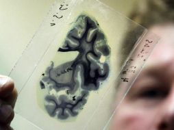 El análisis indica que el incremento de actividad en la zona del cerebro que procesa las emociones desarrolla males en el corazón. EFE / ARCHIVO