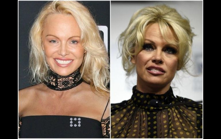 Señalan que Pamela Anderson no lucía ninguna línea de expresión, por lo que surgieron rumores de una intervención estética. ESPECIAL /