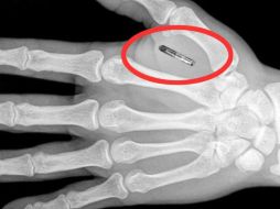 El ‘chip’ se coloca entre el índice y el pulgar, con el objetivo de que reemplace las tarjetas de identificación. ESPECIAL / newsmonkey.be