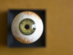 En algunos casos, los depósitos de colesterol amarillo pueden aparecerse en los párpados o en las orillas de los ojos. NTX / ARCHIVO