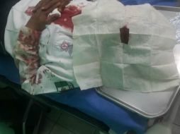 La agresión al policía vial ocurrió en el cruce de Periférico y Colón. ESPECIAL /