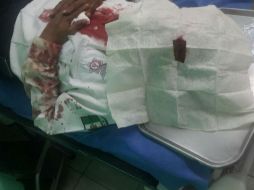 El martes un policía vial de Tlaquepaque fue golpeado en Periférico y Colón, en la terminal de la ruta 619. ESPECIAL /