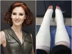 Andere lamentó lo ocurrido y compartió en Twitter una fotografía de sus tobillos vendados. TWITTER / @Chantalandere