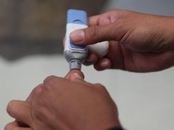 Las personas con diabetes y defensas bajas tienen mayores probabilidades de desarrollarla. EL INFORMADOR / ARCHIVO