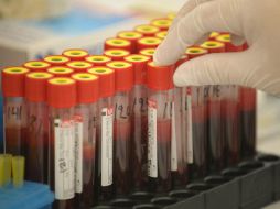 El antígeno prostático y el tacto rectal son las dos pruebas que se recomienda realizar para un diagnóstico temprano. EFE / ARCHIVO