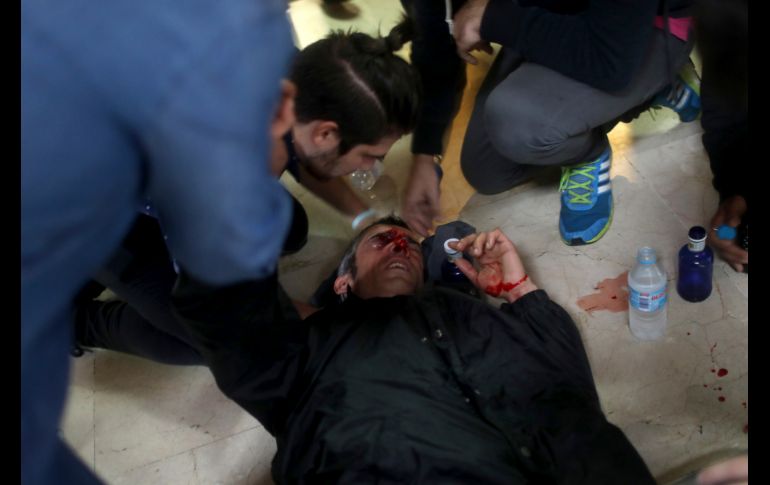 Las autoridades regionales reportaron que la actuación policial causó hoy 761 heridos y contusionados.