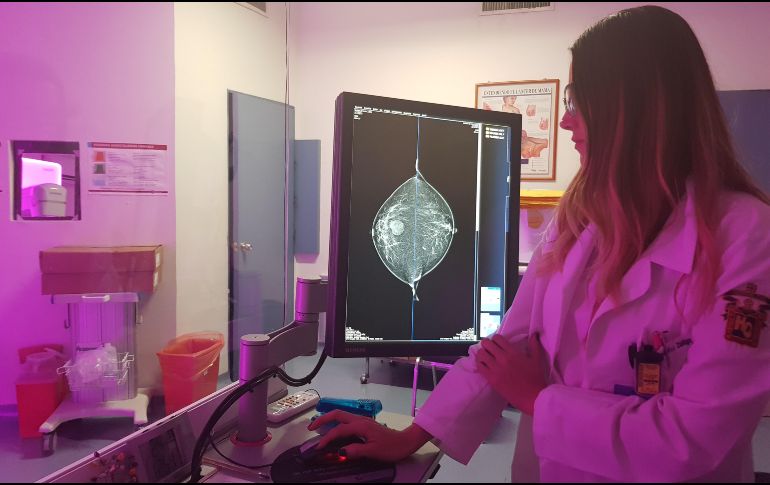 Sólo en Jalisco, en 2017 han fallecido 257 mujeres por cáncer de mama. ESPECIAL